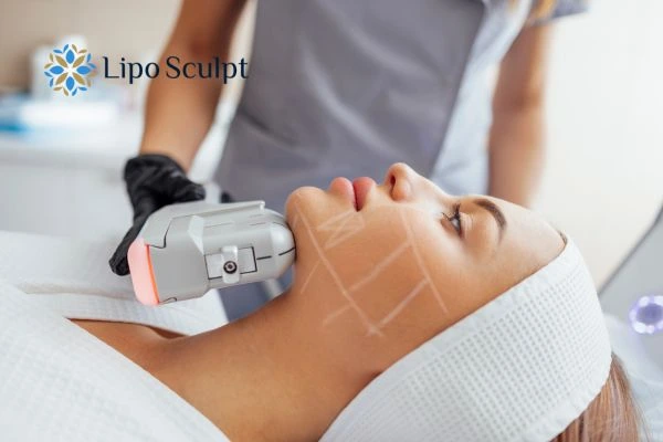 HIFU vs Botulinum Toxin: Understanding the Differences 1 HIFU vs Botox Burley What is the best option for you?
