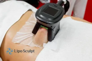 Are The Results From Aqualyx Permanent? 4 Compare Aqualyx Burley to other fat reduction treatments.