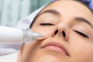 Best Actinic Keratoses Removal 3 Actinic keratoses Burley solutions - book in today!