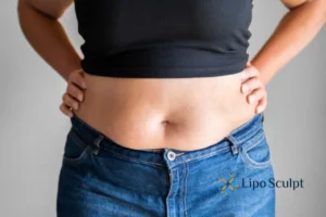 Bidding Farewell to Muffin Tops with Aqualyx Fat Injections 2 Do you wish you could reduce your muffin top Burley With Aqualy fat dissolving injections you can!