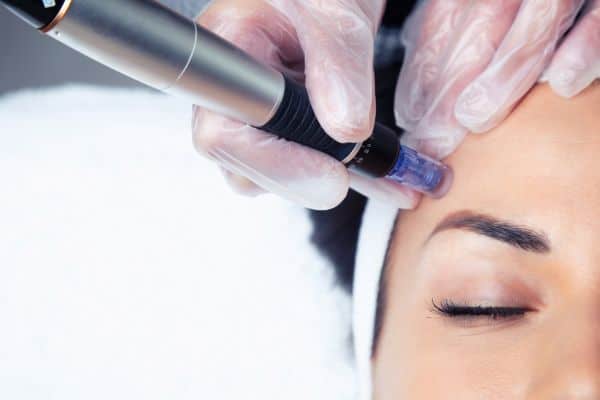 Explaining Total Skin Tightening Treatment and What to Expect 2 What Skin Concerns Can Total Skin Tightening Treatment Help With Burley?